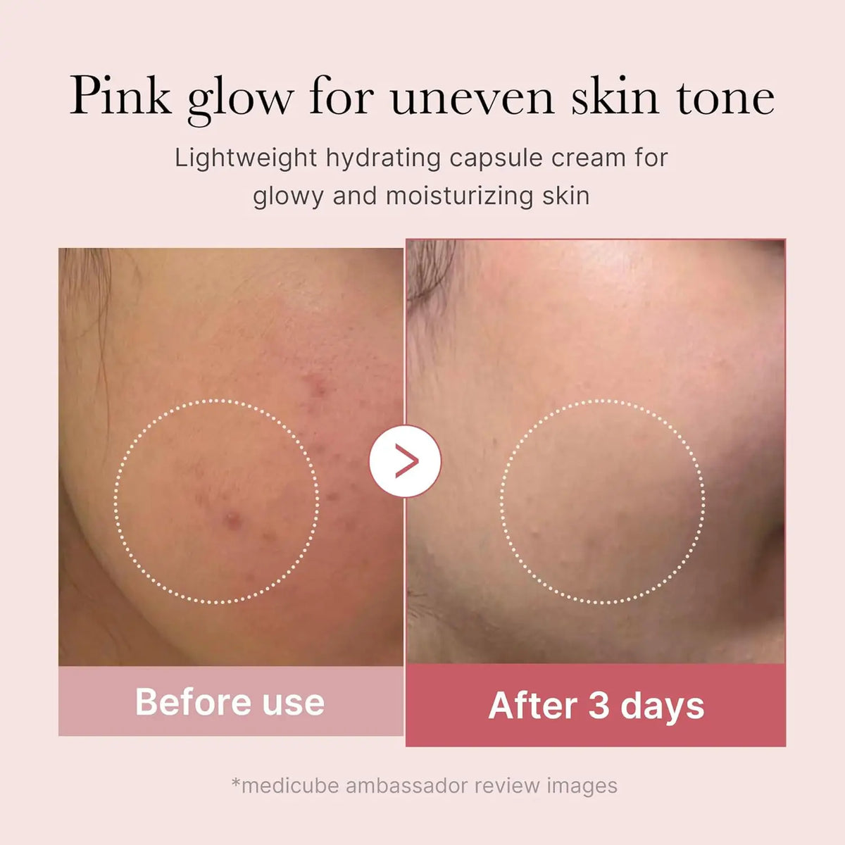 Crema Cápsula Medicube PDRN y Niacinamida, 55 g