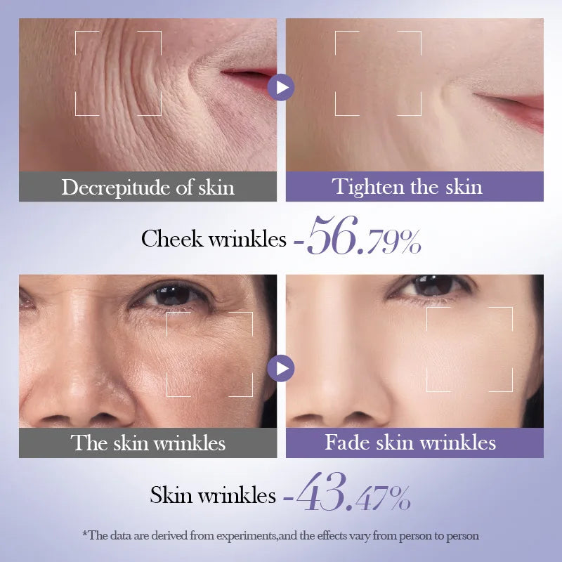 6 Pieces Skin Care Kit Moisturizing Anti Wrinkle Tightening Whitening ReTinol Skin Care Set for