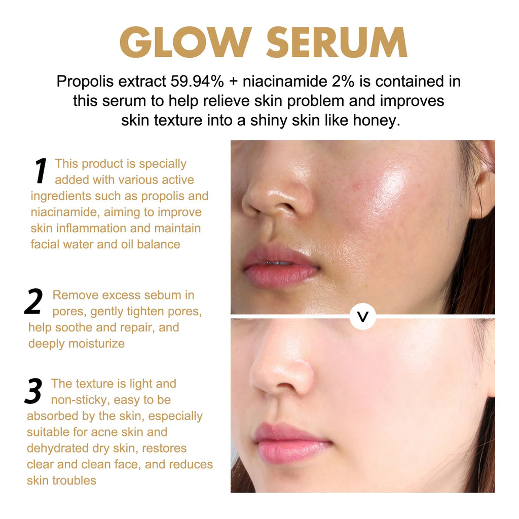 Hydrating Facial Soothing Moisturizer Lighten Acne Marks Whitening Facial Essence