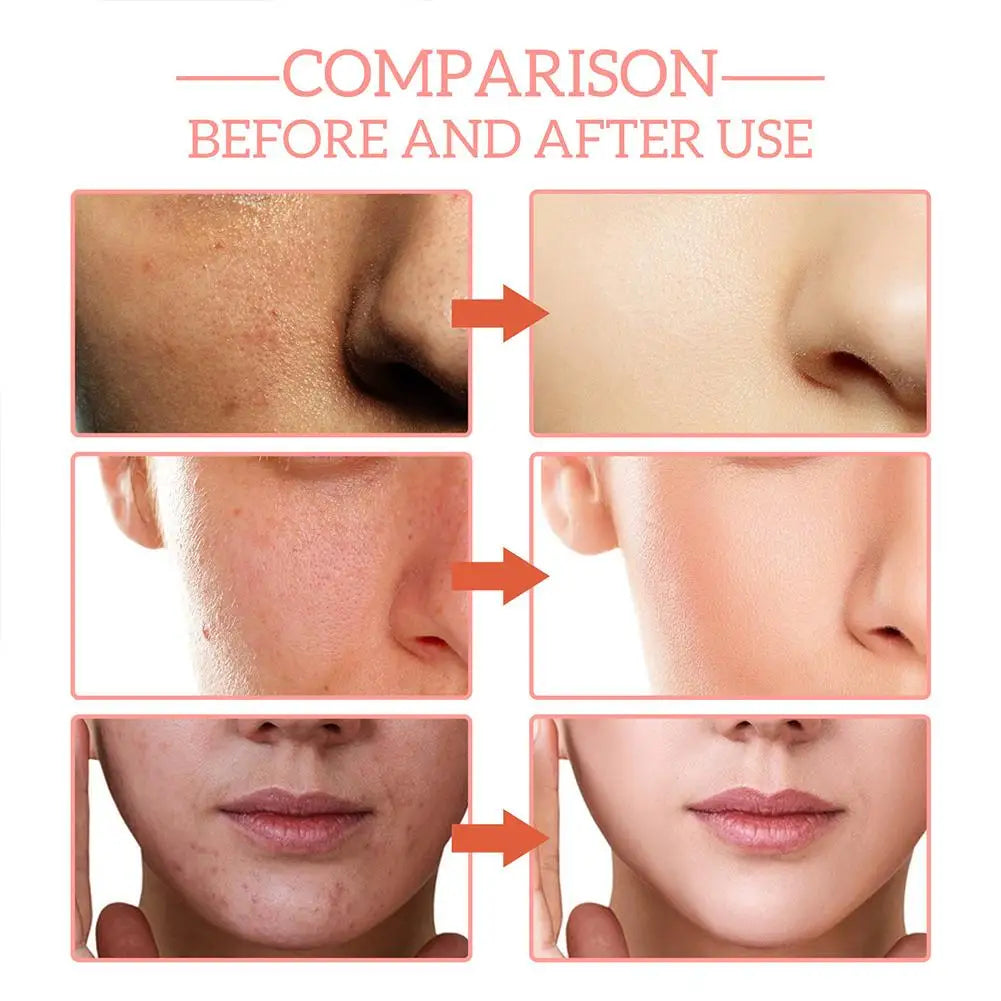 Sérum Facial 5 en 1 con Vitamina C y Ácido Hialurónico, 30 ml