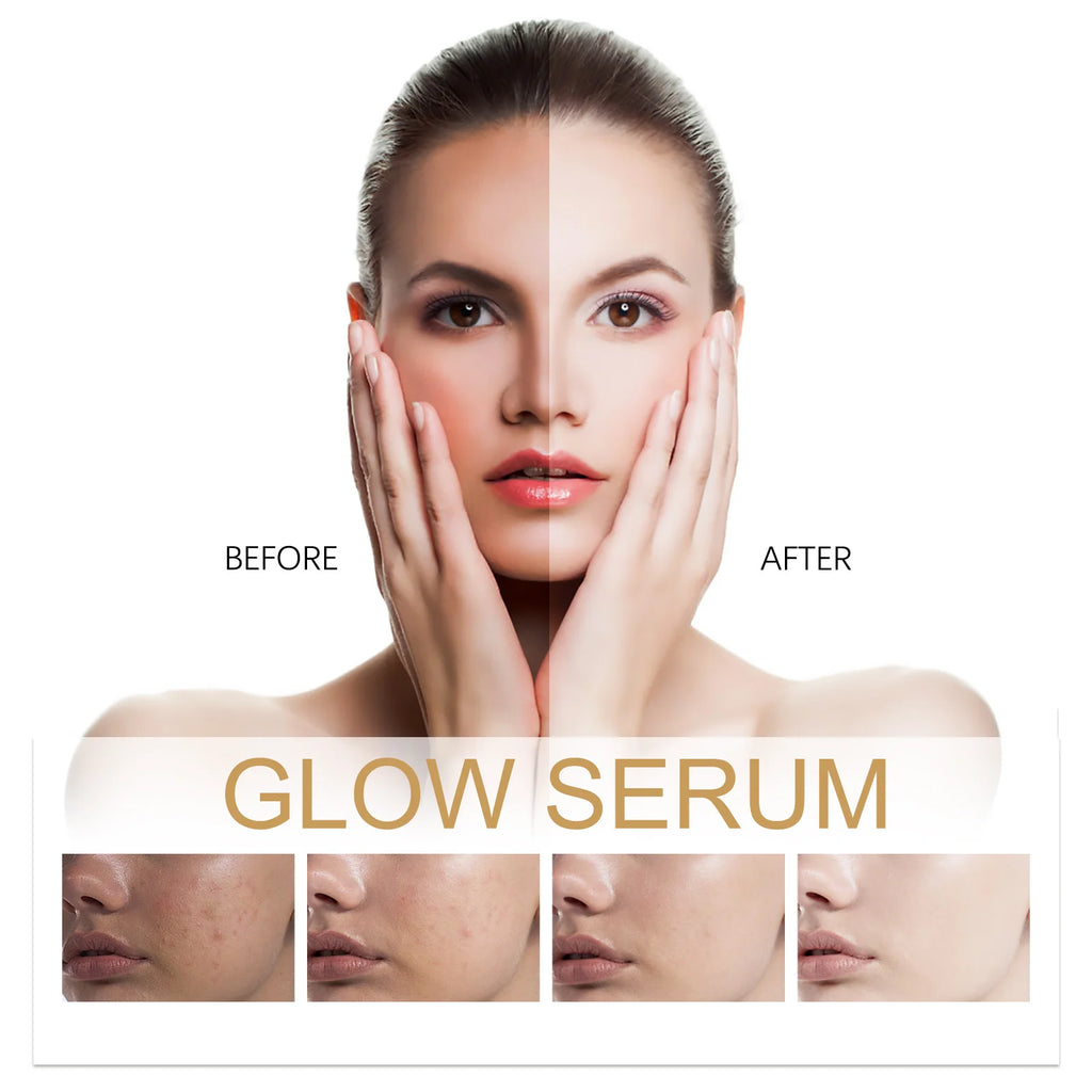 Hydrating Facial Soothing Moisturizer Lighten Acne Marks Whitening Facial Essence