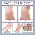Crema en barra para manos y pies con 42 % de urea. Hidratante, exfoliante, suavizante, alivia la sequedad, repara los talones agrietados e hidrata profundamente la piel de los pies.
