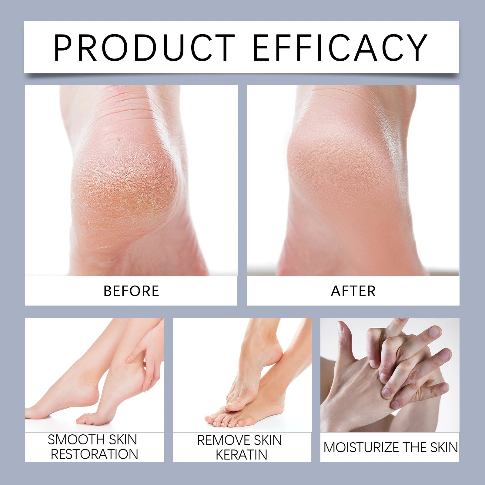Crema en barra para manos y pies con 42 % de urea. Hidratante, exfoliante, suavizante, alivia la sequedad, repara los talones agrietados e hidrata profundamente la piel de los pies.