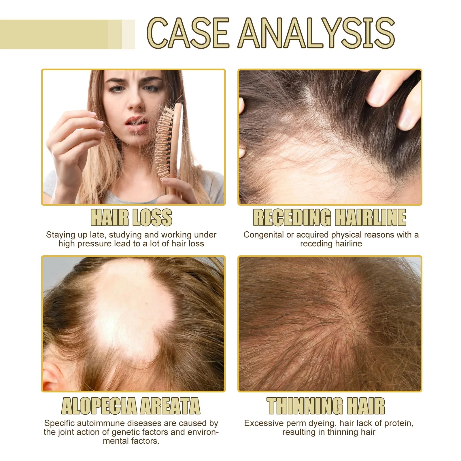 Anti Hair Loss Treatment For Thicker Hair Repairing Dry Damaged Hair Scalp Care With Argan Oil