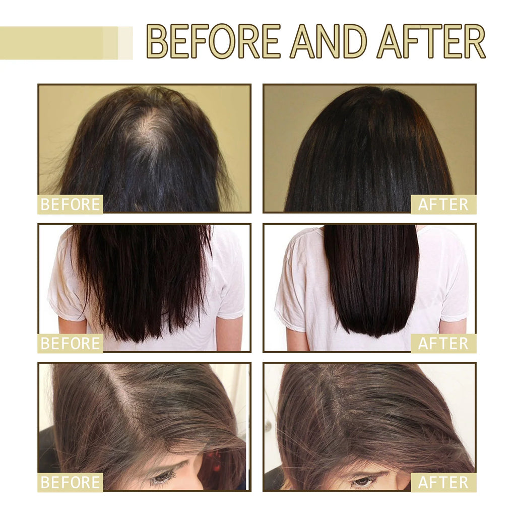 Anti Hair Loss Treatment For Thicker Hair Repairing Dry Damaged Hair Scalp Care With Argan Oil
