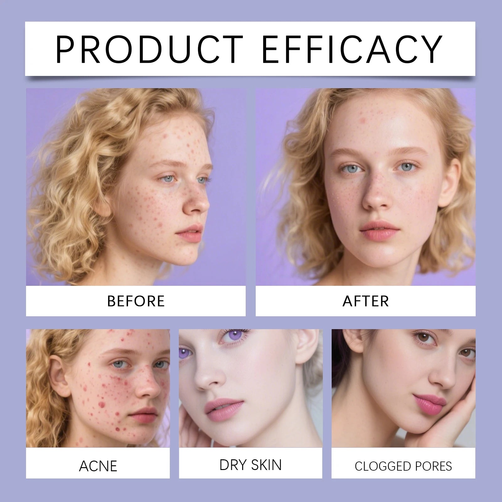 Star Acne Patches 240pcs Salicylic Acid Hydrocolloid Invisible Pimple Patches for Face Spot Treatment Ultra-Thin Gentle Care